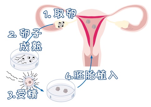 林院长